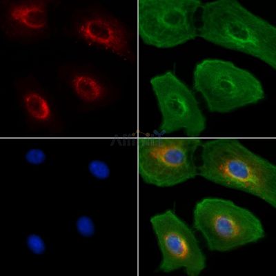 LBR Antibody - DF7356 staining A549 cells(UV treatment) by IF/ICC.
