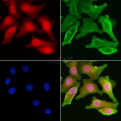 DAP Antibody - DF7628 staining Hela cells by IF/ICC.