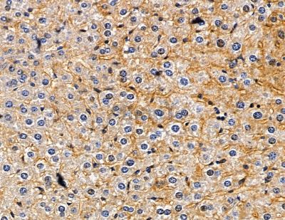 MYL12A Antibody - DF7798 at 1/100 staining mouse liver tissue by IHC-P.
