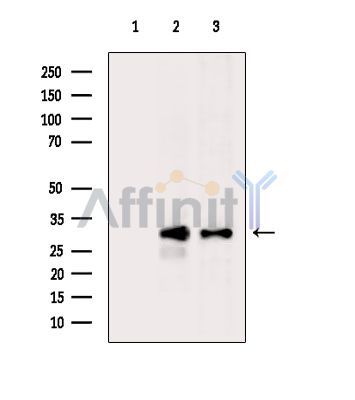 Trypsin-3 Antibody - Western blot analysis of extracts from various samples, using Trypsin-3 Antibody.