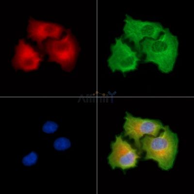 FAM111B Antibody - DF8839 staining A549 cells by IF/ICC.