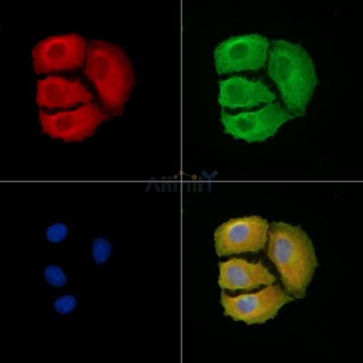PLXDC2 Antibody - DF8840 staining A549 cells by IF/ICC.