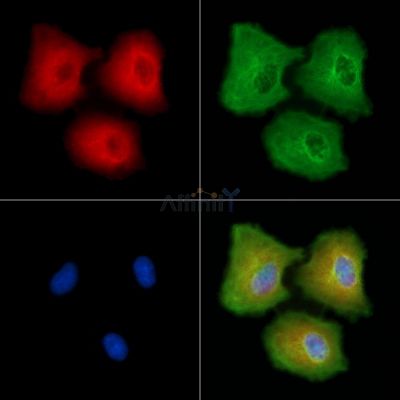 PCDH-X/Y Antibody - DF8867 staining A549 cells by IF/ICC.