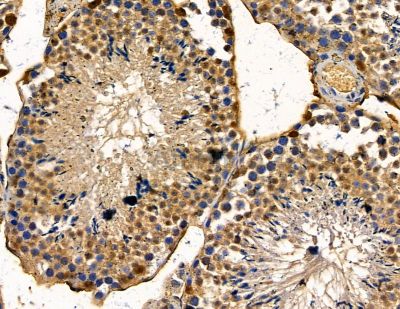 Ubinuclein Antibody - DF8873 at 1/100 staining mouse testis tissue by IHC-P.