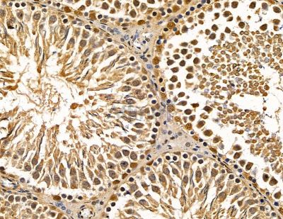 Ubinuclein Antibody - DF8873 at 1/100 staining rat testis tissue by IHC-P.