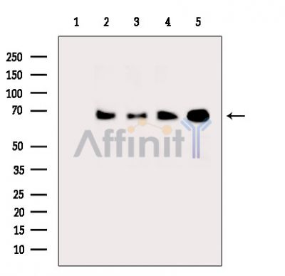 Collagen VIII  alpha 2 Antibody - Western blot analysis of extracts from various samples, using Collagen VIII  alpha 2 Antibody.