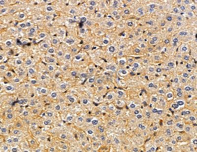 Cytochrome P450 4F8 Antibody - DF8928 at 1/100 staining mouse liver tissue by IHC-P.