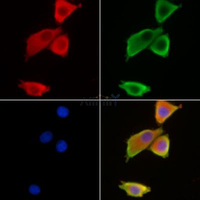 AQP10 Antibody - DF9221 staining HepG2 cells by IF/ICC.