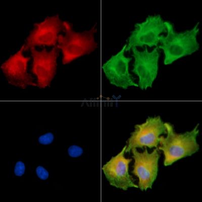 CPXM2 Antibody - DF9342 staining A549 cells by IF/ICC.