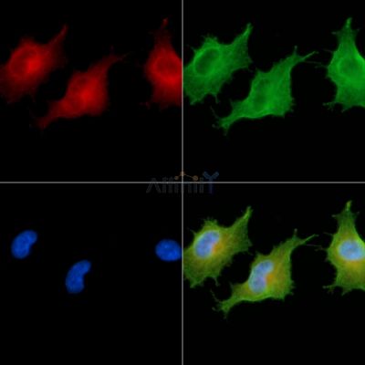 CSPP1 Antibody - DF9366 staining A549 cells by IF/ICC.