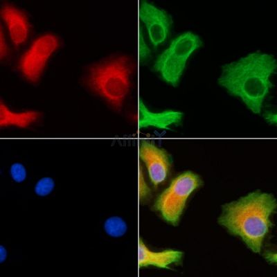 MARCH6 Antibody - DF9482 staining HepG2 cells by IF/ICC.
