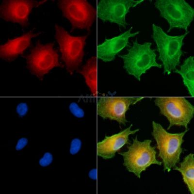 HSD17B12 Antibody - DF9505 staining A549 cells by IF/ICC.
