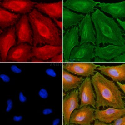 HLA-DMA Antibody - DF9572 staining A549 cells(UV treatment) by IF/ICC.