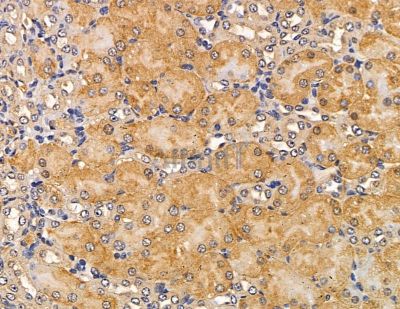 MYO3B Antibody - DF9652 at 1/100 staining mouse kidney tissue by IHC-P.