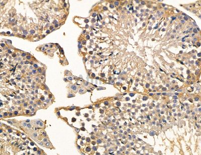 MYO3B Antibody - DF9652 at 1/100 staining mouse testis tissue by IHC-P.