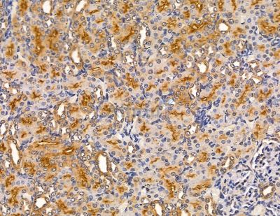 MYO3B Antibody - DF9652 at 1/100 staining rat kidney tissue by IHC-P.