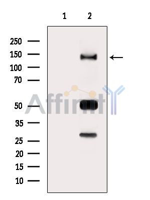 RAPH1 Antibody - Western blot analysis of extracts from MCF7 cells(serum starvation treatment), using RAPH1 Antibody.