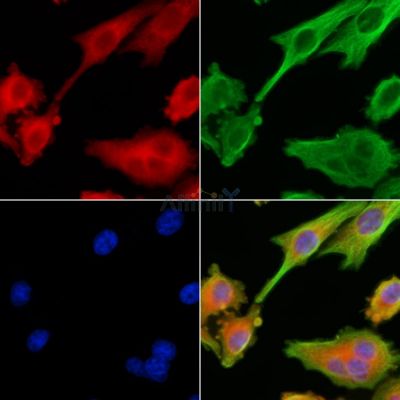 RAB40C Antibody - DF9832 staining HepG2 cells by IF/ICC.