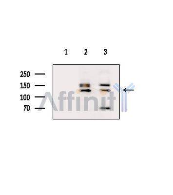 RHG20 Antibody - Western blot analysis of extracts from various samples, using RHG20 Antibody.