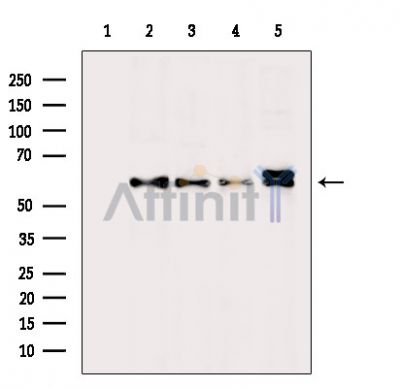 VRK1 Antibody - Western blot analysis of extracts from various samples, using VRK1 Antibody.