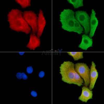 SH3GL3 Antibody - DF9907 staining Hela cells by IF/ICC.