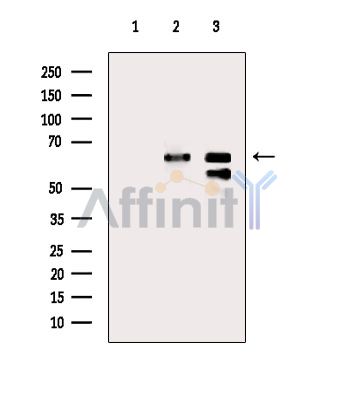 SLC6A12 Antibody - Western blot analysis of extracts from various samples, using SLC6A12 Antibody.