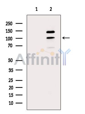 BTF3L2 Antibody - Western blot analysis of extracts from MC-3T3-E1 cells(H2O2 treatment), using BTF3L2 Antibody.