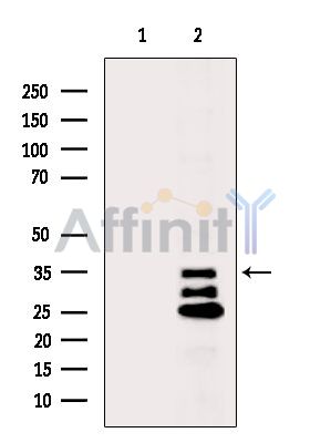 BTF3L3 Antibody - Western blot analysis of extracts from P19 cells(H2O2 treatment), using BTF3L3 Antibody.