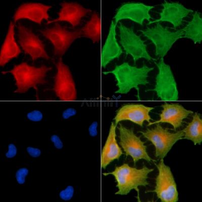 MMTAG2 Antibody - AF0421 staining A549 cells by IF/ICC.