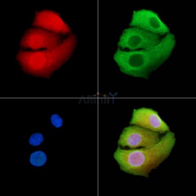 NADAP Antibody - AF0468 staining Hela cells by IF/ICC.