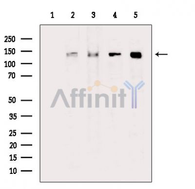 HER2/ErbB2 Antibody - Western blot analysis of extracts from various samples, using HER2/ErbB2 Antibody.