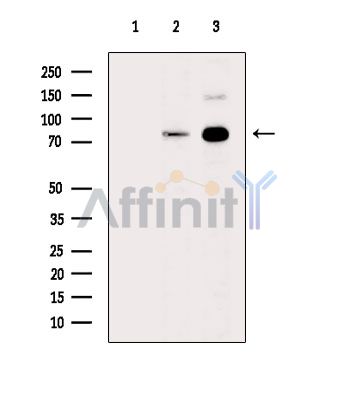 RSK2 Antibody - Western blot analysis of extracts from various samples, using RSK2 Antibody.