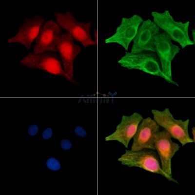 Phospho-SRF (Ser99)[Ser103] Antibody - AF3160 staining Hela cells(Etoposide 25μm 5h) by IF/ICC.