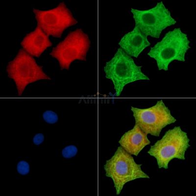Phospho-mTOR (Ser2448) Antibody - AF3308 staining Hela cells(Etoposide 25μm 5h) by IF/ICC.