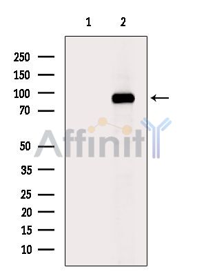 Phospho-EEF2 (Thr57) Antibody - Western blot analysis of extracts from Hela cells(heat-shock treatment), using Phospho-EEF2 (Thr57) Antibody.