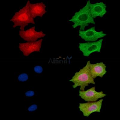 Phospho-PKC gamma (Thr514) Antibody - AF8347 staining Hela cells(Etoposide 25μm 5h) by IF/ICC.