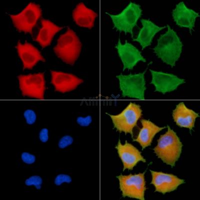 COL10A1 Antibody - DF13756 staining A549 cells by IF/ICC.