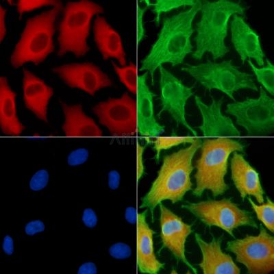 Pellino-1 Antibody - DF13759 staining A549 cells by IF/ICC.