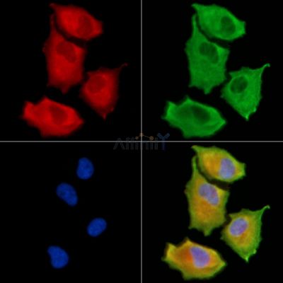 KLHL22 Antibody - DF13770 staining A549 cells by IF/ICC.