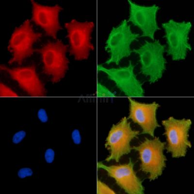 TRIAD3 Antibody - DF13775 staining A549 cells by IF/ICC.