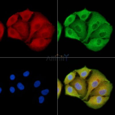 SCN3B Antibody - DF13794 staining A549 cells by IF/ICC.