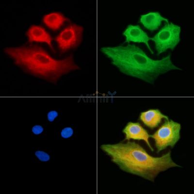 TFB2M Antibody - DF13810 staining A549 cells by IF/ICC.