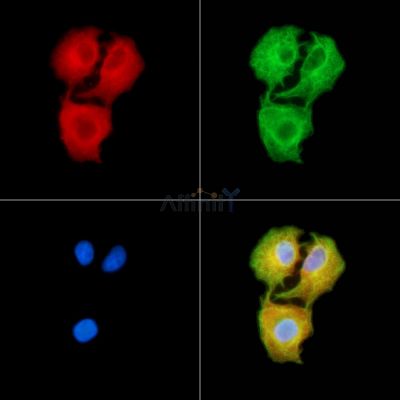 AMCase Antibody - DF13816 staining A549 cells by IF/ICC.