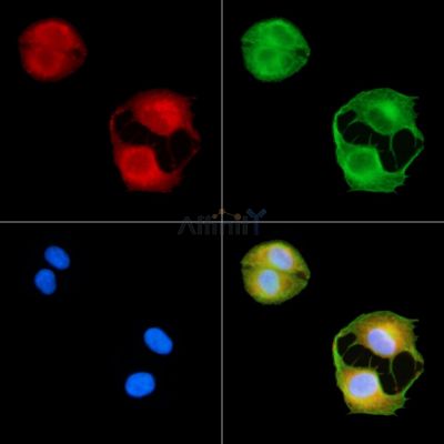 Sprouty 1 Antibody - DF13819 staining A549 cells by IF/ICC.