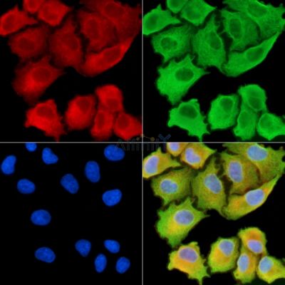 ANKH Antibody - DF13836 staining A549 cells by IF/ICC.