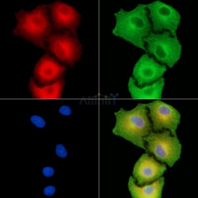 Corneodesmosin Antibody - DF13837 staining A549 cells by IF/ICC.