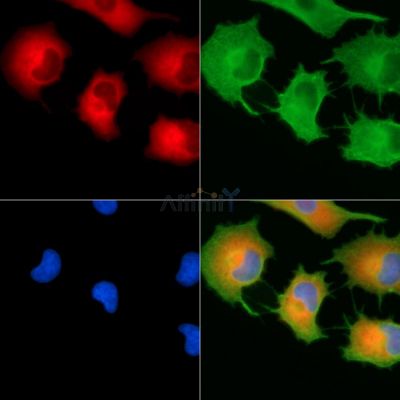 RRBP1 Antibody - DF13844 staining A549 cells by IF/ICC.