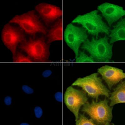 Argininosuccinate Lyase Antibody - DF13850 staining A549 cells by IF/ICC.