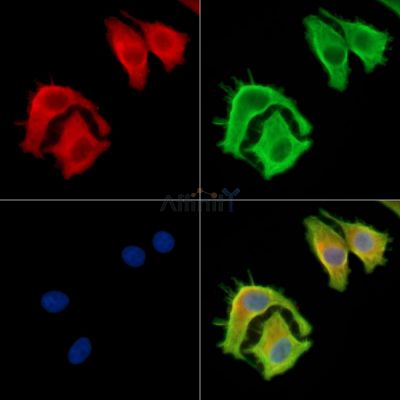 NAA60 Antibody - DF13864 staining HepG2 cells by IF/ICC.