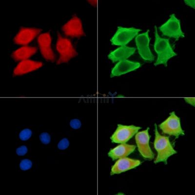 Protease Inhibitor 15 Antibody - DF13876 staining HepG2 cells by IF/ICC.
